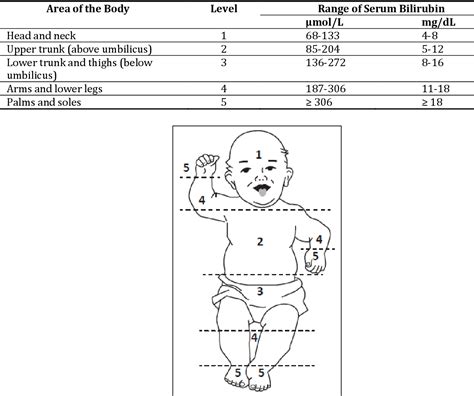 Pdf Methods For Determining Bilirubin Level In Neonatal Jaundice