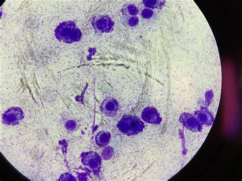 Mast Cell Tumour Case Gallery Pathology And Cytology