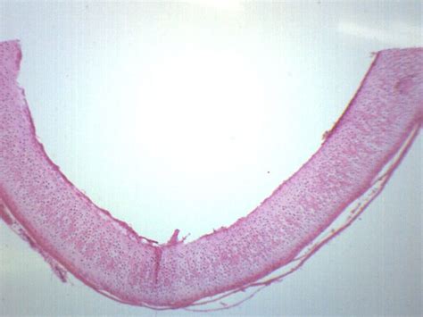 Eisco Prepared Microscope Slide Hyaline Cartilage Section From Mammal