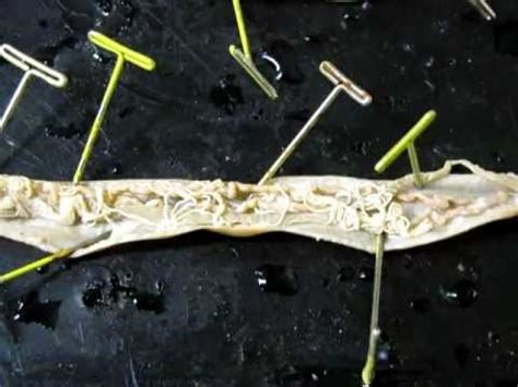 Roundworm Anatomy - YouTube