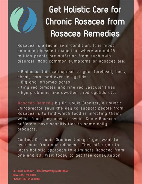 Ppt Get Holistic Care For Chronic Rosacea From Rosacea Remedies