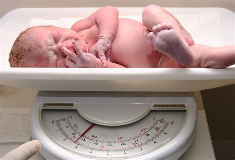 Complications Associated With Babies Born At 36 Weeks