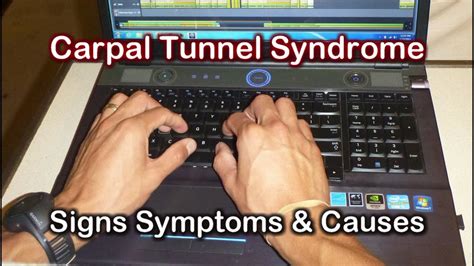 What is the carpal ligament? Carpal Tunnel Signs Symptoms & Causes of Carpal Tunnel ...