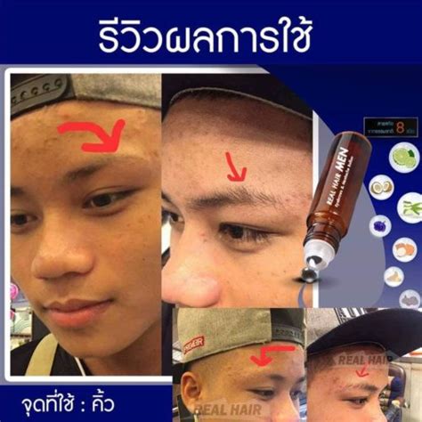 Lượt xem 3,3 n2 năm trước. {{รวมรีวิวจากเว็บดัง}} Real Hair Serum ปลูกคิ้ว หนวด เครา ...