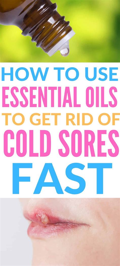 Essential Oils For Cold Sores Natural Cold Sore Remedy Natural Cold