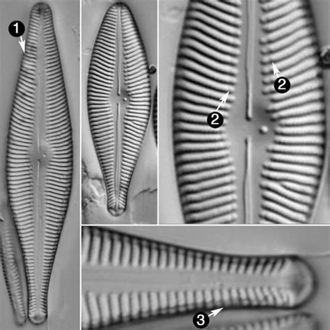 Gomphoneis Septa Species Diatoms Of North America