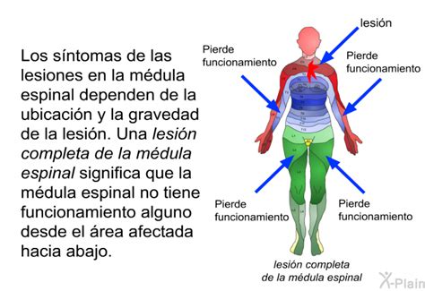 Lesion En La Medula Espinal Descargar Manual