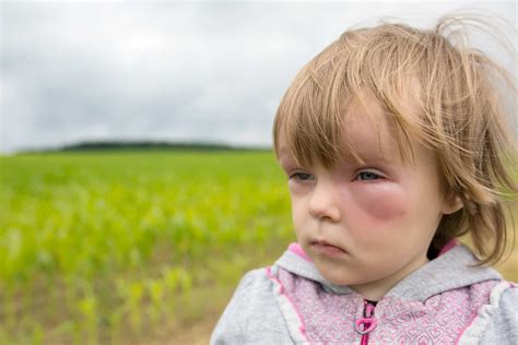 Serious Health Symptoms In Children People Should Never Ignore
