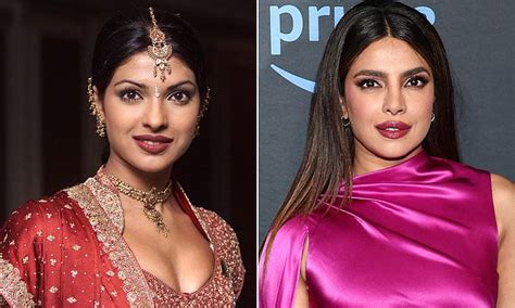 Priyanka Chopra Gets Candid About Botched Early 2000s Surgery Which Led To Plastic Chopra