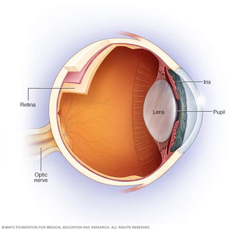 Optic Neuritis Nch Healthcare System