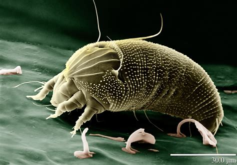 Do I Have Dust Mites Learn More From Stock Environmental