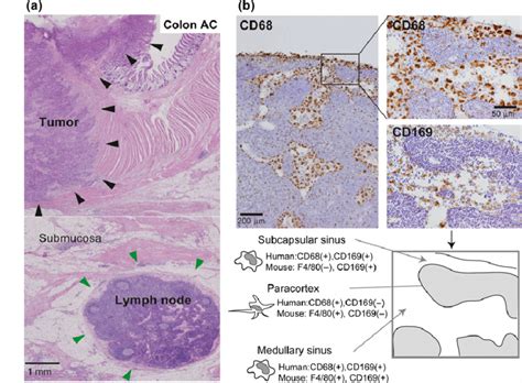 Histological Distribution Of Macrophages In A Lymph Node Ln A The