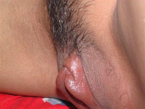 Pussy Pump Extreme Big Lips Big Hole Big Clit Bizzare Hot