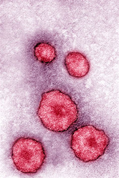 Mumps Virus Tem Stock Image C0458287 Science Photo Library