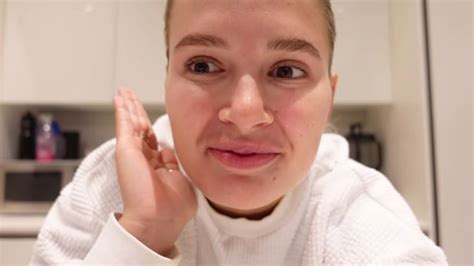 Molly Mae Hague Shows Off Stretched Natural Lips After Dissolving Lip