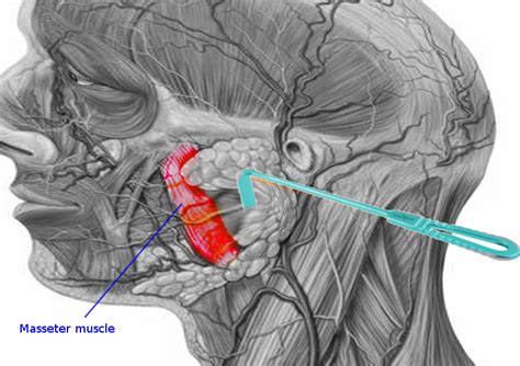 Anatomy Head And Neck Masseter Muscle Article
