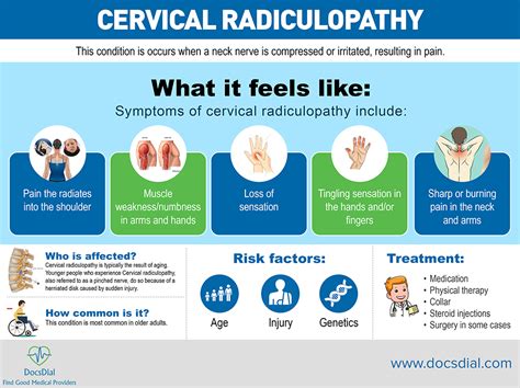 Cervical Radiculopathy Symptoms Causes Diagnosis And Treatment Images