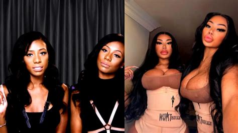 Clermont Twins Plastic Surgery Comparing Before And After Photos