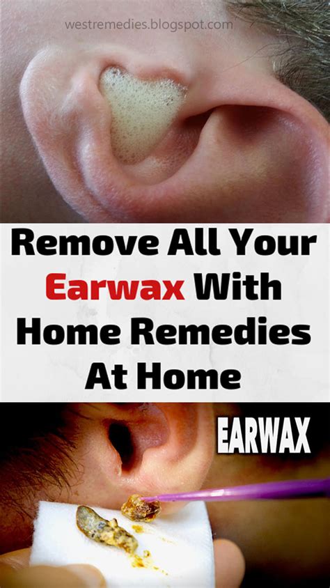 Remove All Your Earwax With Home Remedies At Home In 2020 With Images