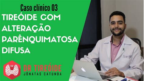Tireoidopatia Difusa O Que é