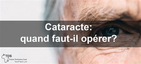 Cataracte Définition Causes Symptômes Et Traitements