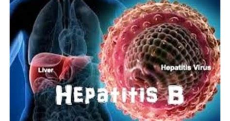 Hal ini terjadi akibat sistem kekebalan dalam tubuh tidak dapat melawan infeksi akut. Medic Blueprint: Hepatitis B dan C (resiko, pencegahan dan ...