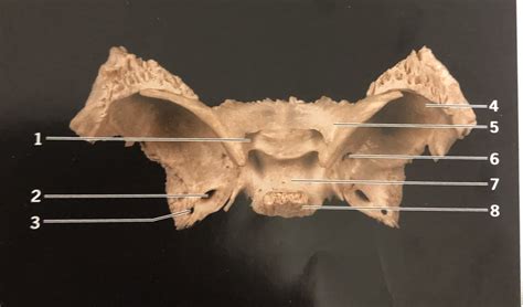 Axial Lab Sphenoid Bone Superior View Diagram Quizlet