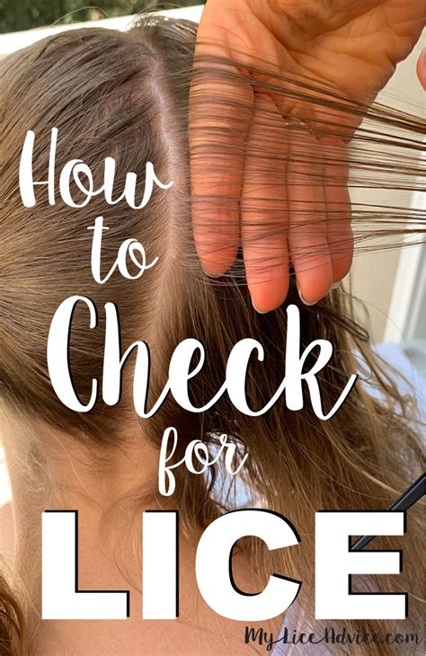 A Closer Look At Lice Bites And Rashes With Pictures My Lice Advice
