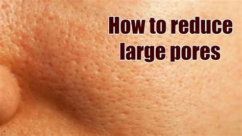 Well, wouldn't i agree more. How To Reduce Large Pores.Best Pore Minimizer Products ...