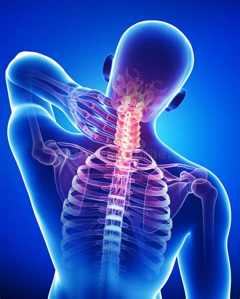 3d video tutorials and interactive modules on the anatomy of the back including anatomy of the musculature, vertebral column, joints and ligaments. Anatomy Of Male Back And Neck Pain In Blue Stock Illustration - Illustration of anatomical ...