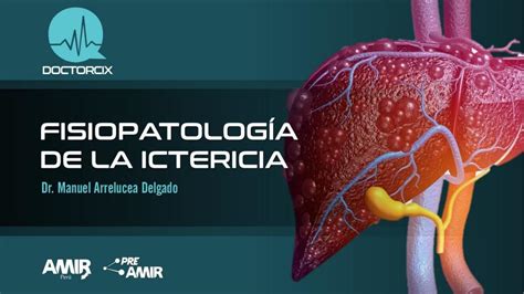FisiopatologÍa Y Aspectos ClÍnicos De La Ictericia Udocz