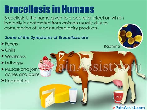 Brucellosis In Humans Treatment Symptoms Causes