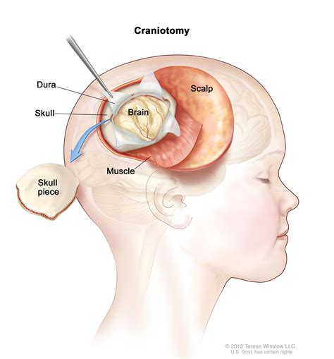 Neuroblastoma is the most common form of cancer in children under the age of one, and accounts for about 6% of all types of childhood cancers. Childhood Brain and Spinal Cord Tumors Treatment Overview ...