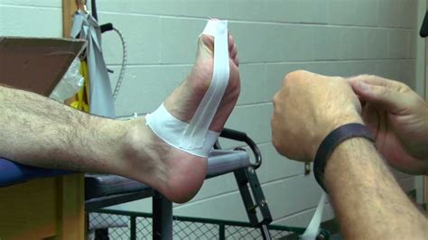 Turf toe taping is very beneficial to perform to take pressure off the big toe joint. Turf Toe Taping - YouTube