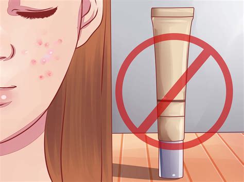 Headache prior to pregnancy is a significant predictor of headache during and after pregnancy. How to Avoid Skin Pigmentation During Pregnancy (with ...
