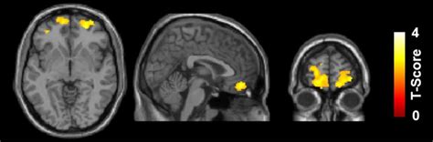 What Weed Actually Does To Your Brain Heres What Fmri Scans Show