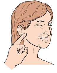 It is a sign of tetany. Chvostek's sign | definition of Chvostek's sign by Medical ...