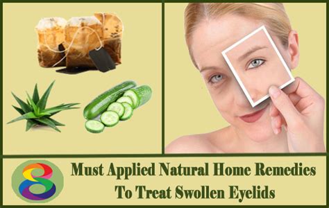 Swollen Eyelids 8 Natural Home Remedies To Get It Cured Right Away