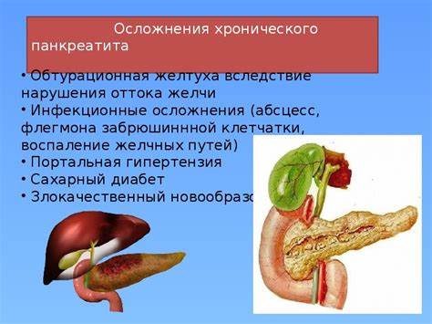 Какую диету при хроническом панкреатите