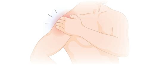Shoulder Impingement Subacromial Pain Syndrome Your Physio Online