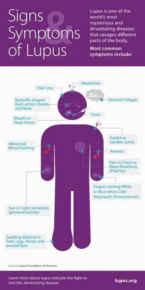 Common Symptoms Lupus Facts Lupus Symptoms Lupus Signs