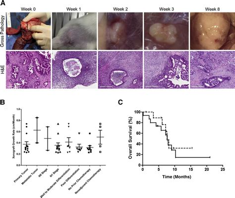 Patient Derived Pancreatic Cancer Pc Xenografts Demonstrate Rapid