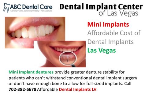 Cost Of Mini Implant Dentures Dental News Network