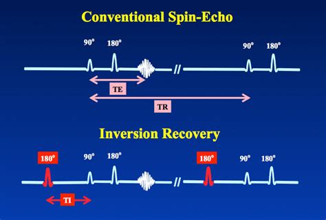 Inversion Recovery Questions And Answers In Mri