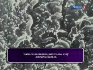 Язва желудка как похудеть