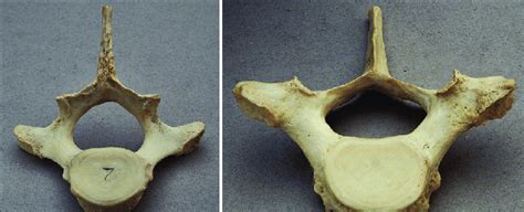 Images Of The C Vertebra Of The Dolphin As Viewed In The Erect Download Scientific Diagram