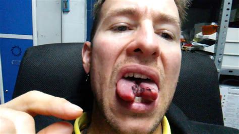 5dialengua Bifida Tongue Split Youtube