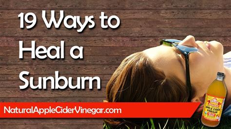 19 Amazing Ways To Heal And Soothe A Sunburn Youtube