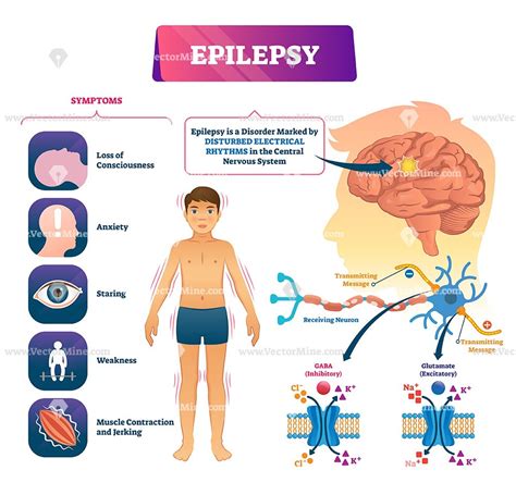 What Anatomy Is Involved In Epilepsy Anatomy