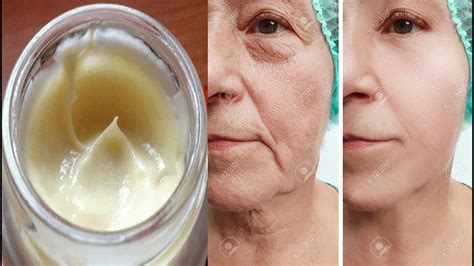 Cómo Eliminar Las Arrugas De La Cara En Una Semana Con Estas Cremas